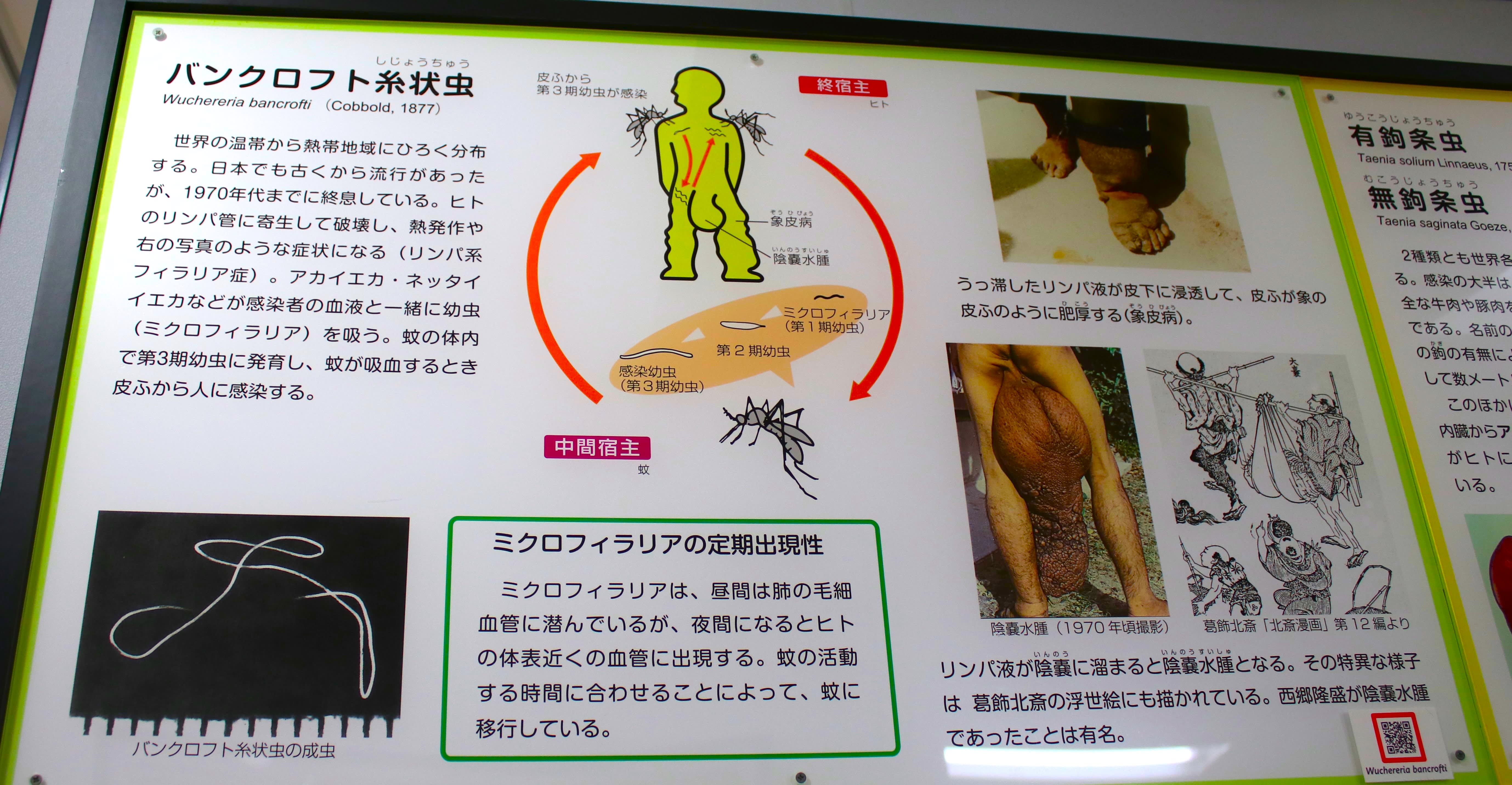 ビル・ゲイツも驚嘆の体内に寄生した8.8mのサナダムシ!「目黒 ビル・ゲイツも驚嘆の体内に寄生した8.8mのサナダムシ!「目黒