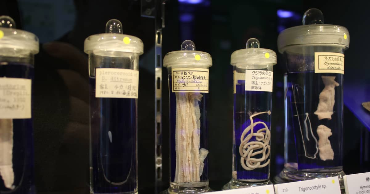 ビル・ゲイツも驚嘆の体内に寄生した8.8mのサナダムシ！「目黒寄生虫館」寄生虫の実態と撲滅の歴史 | FRIDAYデジタル