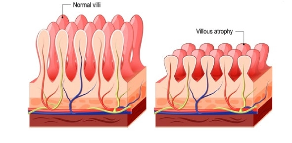 Quiz Image