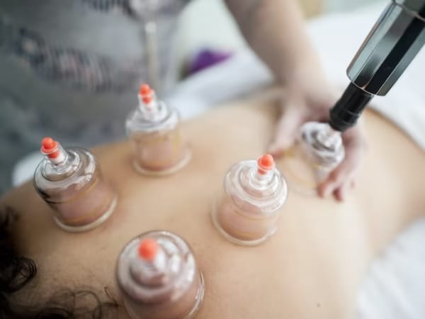 Cupping Therapy session in Lyon