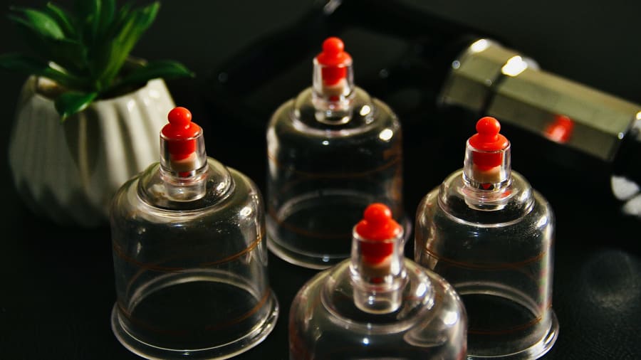 Cupping Therapy