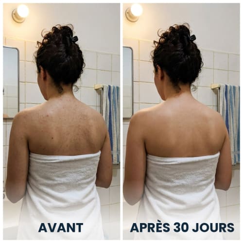 Avant et après 30 jours d’utilisation