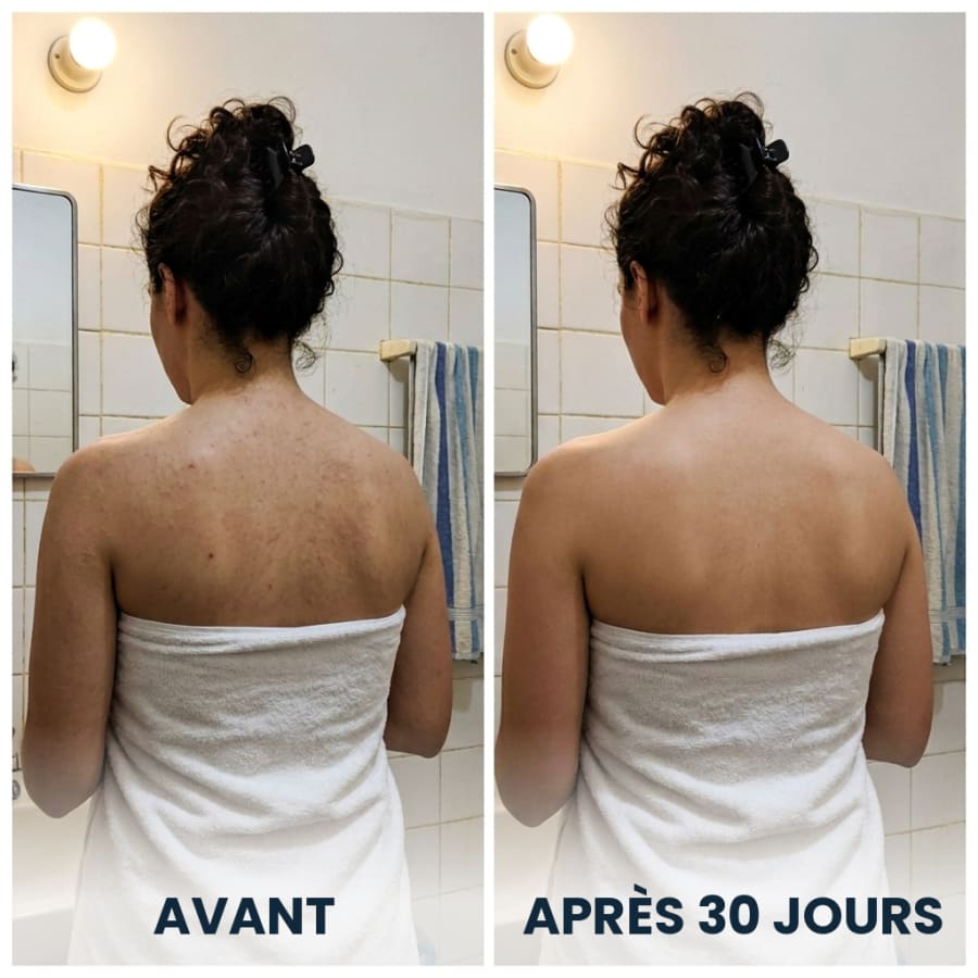 Avant et après 30 jours d’utilisation