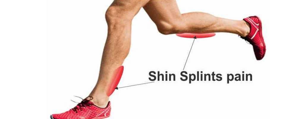 posterior shin splints exercises