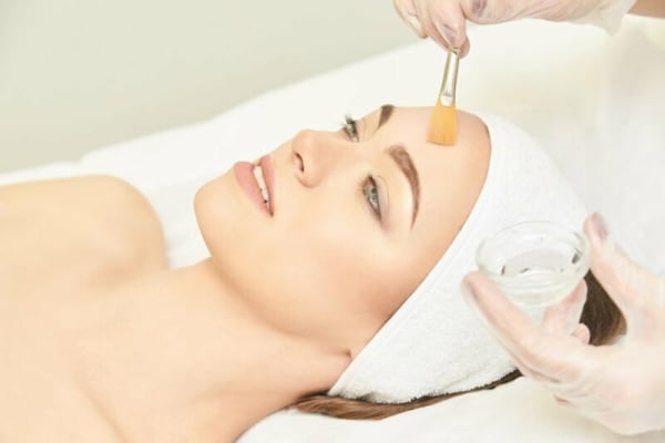Chemical peel results
