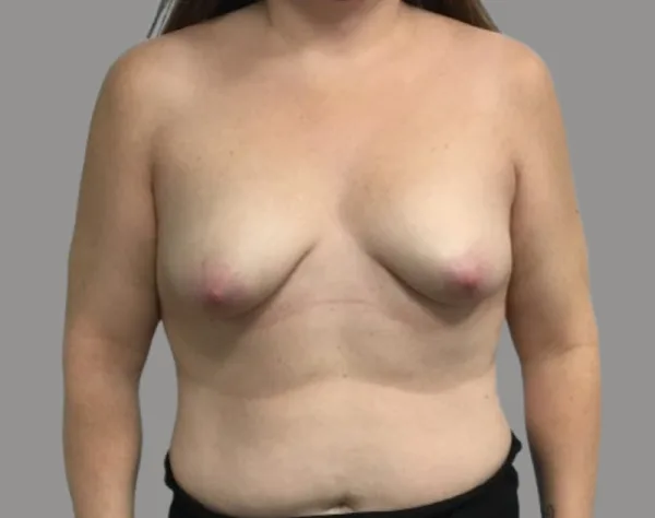 Patient #70 before