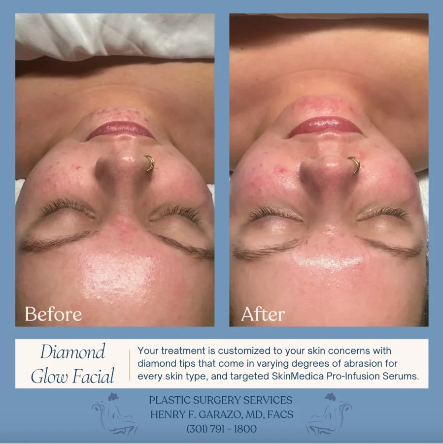 Professional facials deliver results you can't achieve at home