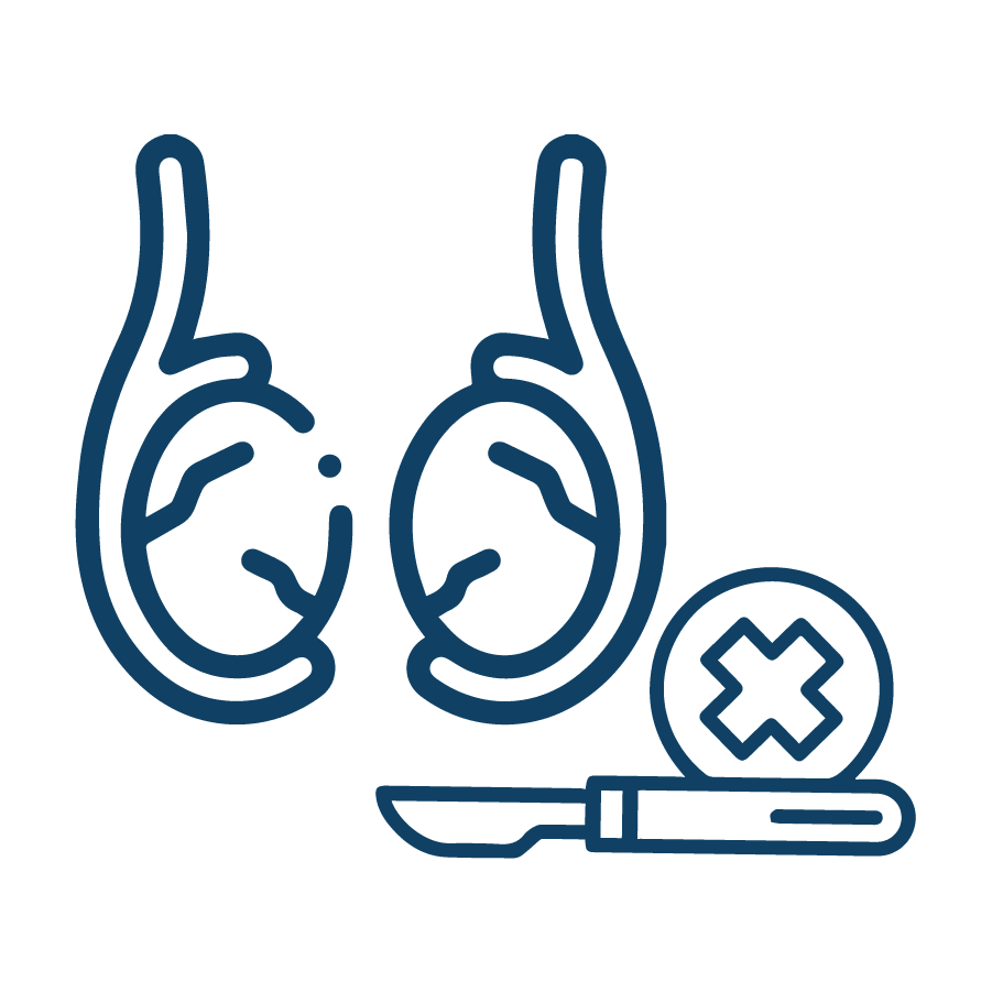 Varicocele