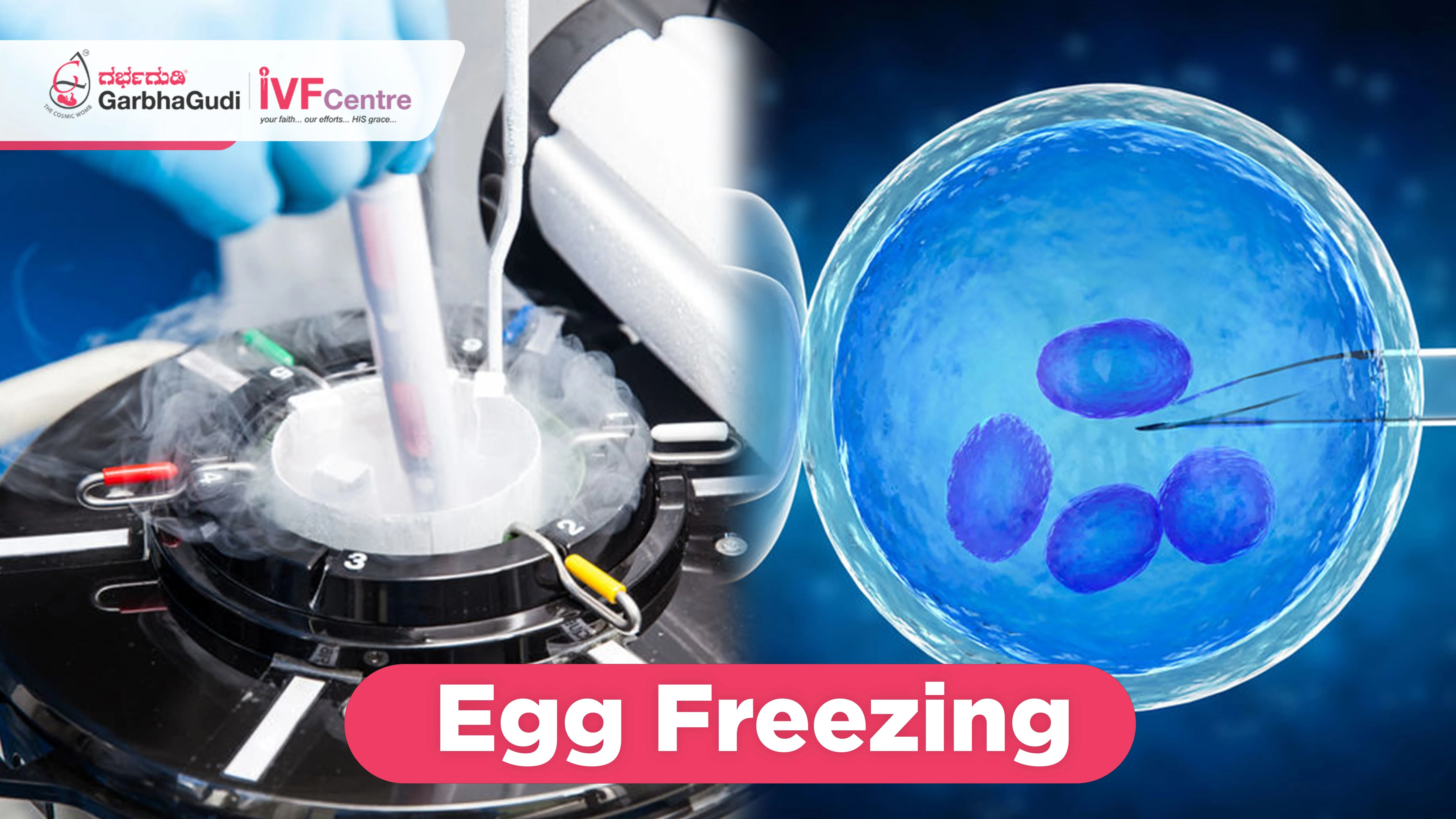 Sperm Freezing