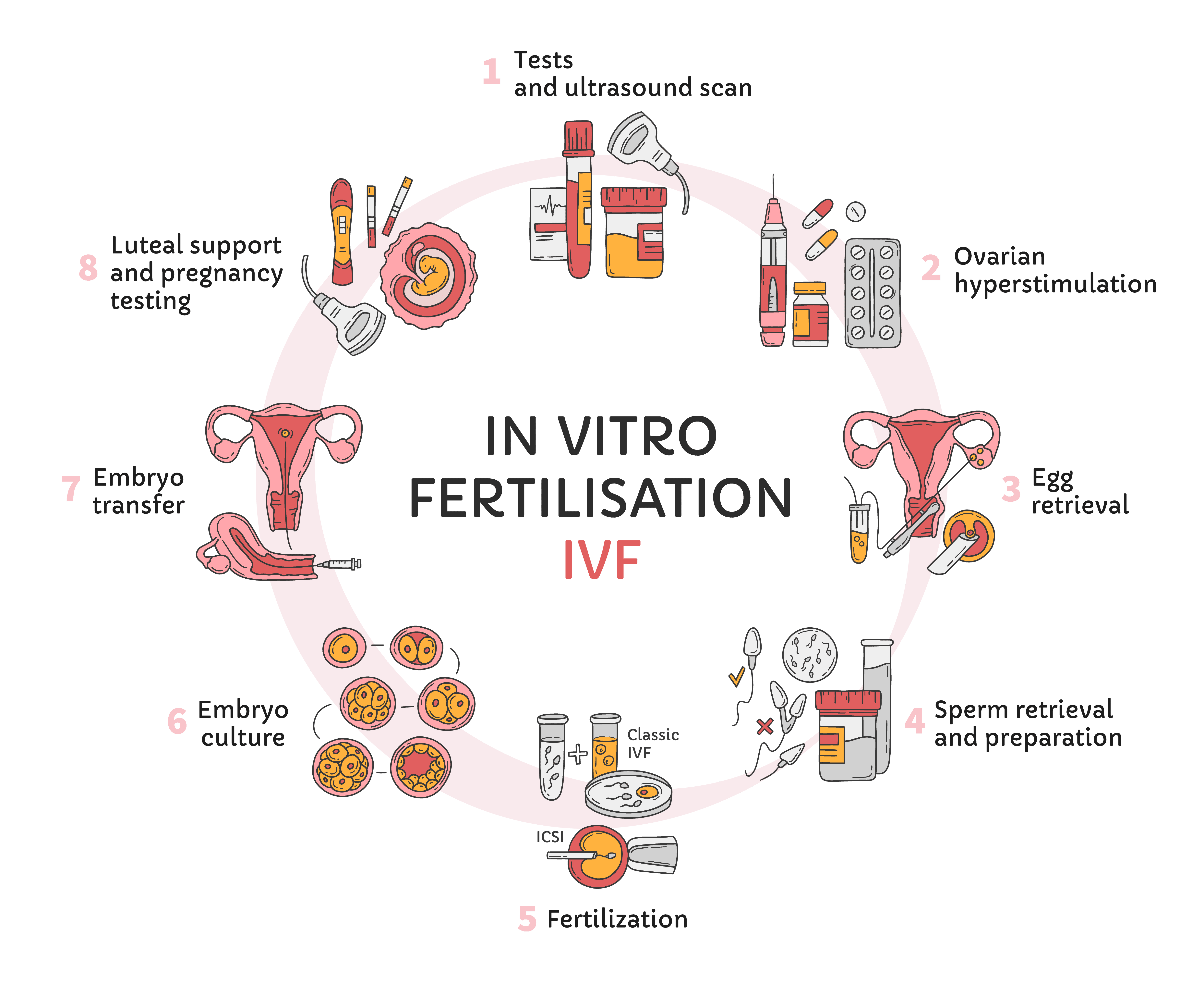 Process of IVF Treatment in Bangalore