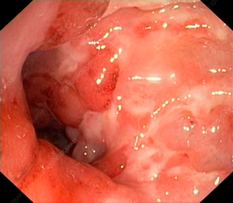 Endoscopic image