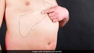 The liver is within the abdominal cavity but actually is placed mostly behind the ribs on the lower right rib cage.

Sometimes the liver is enlarged with fatty liver but usually only mild enlargement