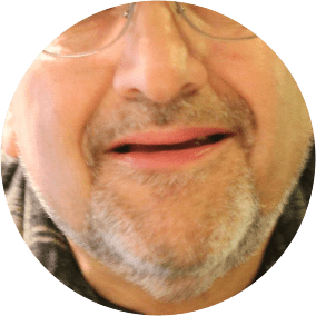 DB