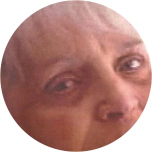 MR