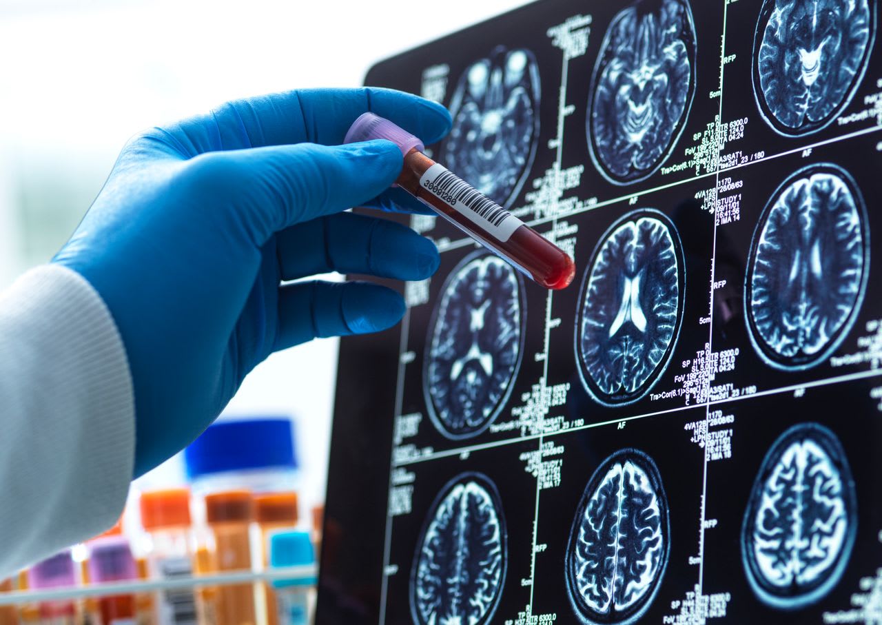 【写真】ラルフ・ウォルド・エマーソン