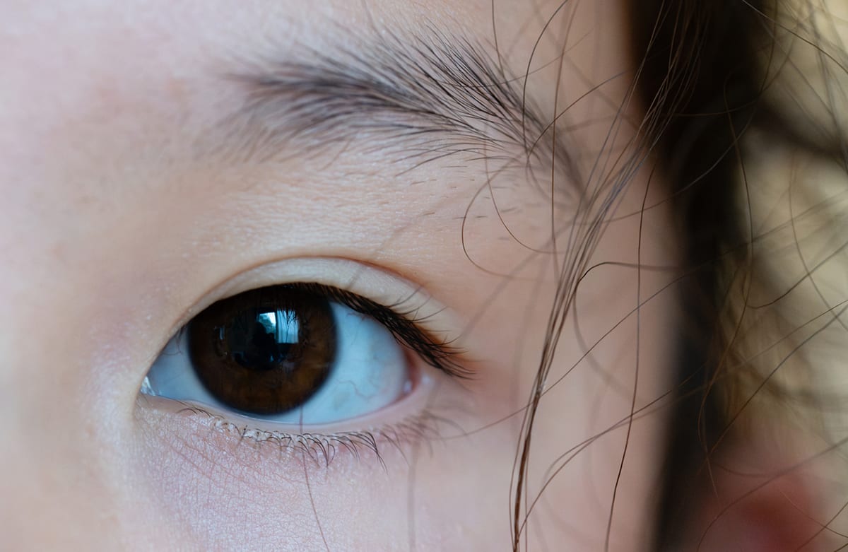 放っておくと病気のリスクが40倍に!? 子どもの「目が悪い」が