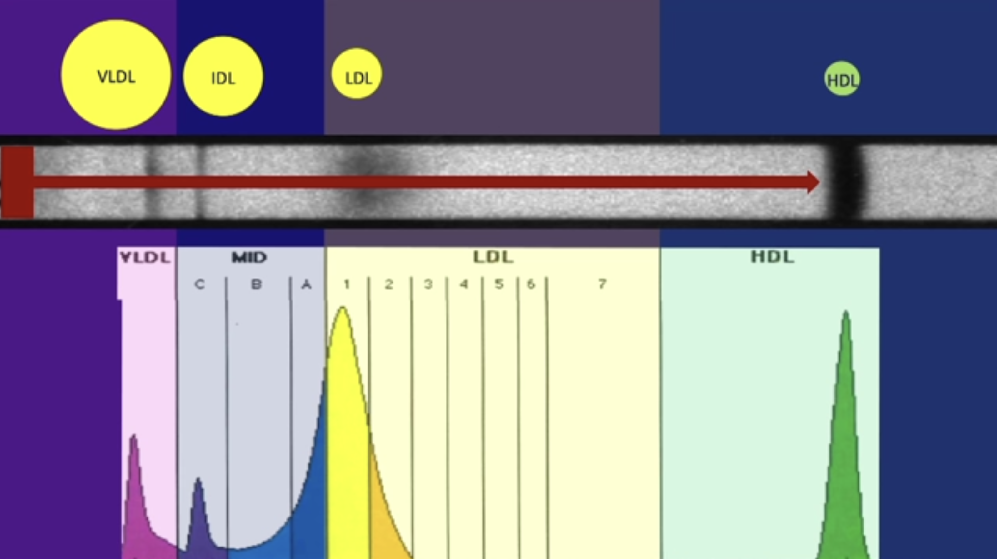 Pattern A LDL has a single smooth peak in gel electrophoresis, which means you probably don't have glycated or oxidized LDL