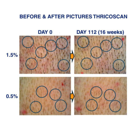 Power Follicopeptide Solution - Hair Activation Formula - Skickas I December