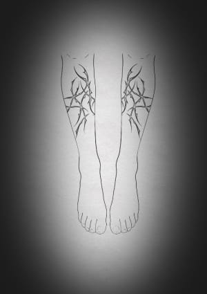 Image of Discounted Placement 2