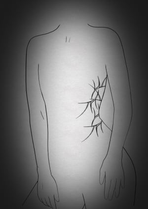 Image of Discounted Placement 3