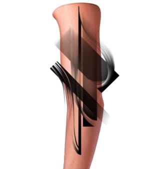 Image of Abstract 1.
