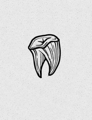 Image of Tooth 