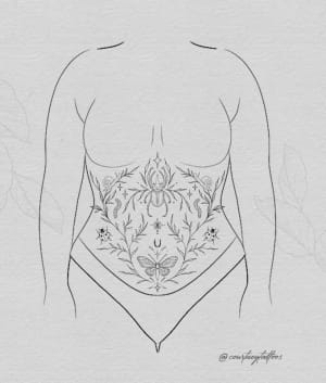 Image of Tummy bugs #1