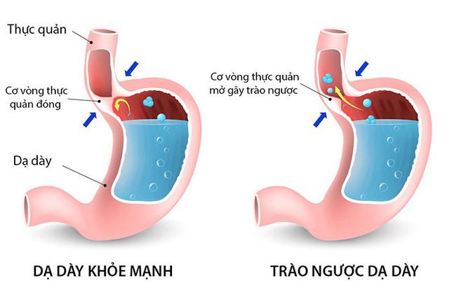 trao-nguoc-da-day-thuc-quan-16649511867241802047920.jpg