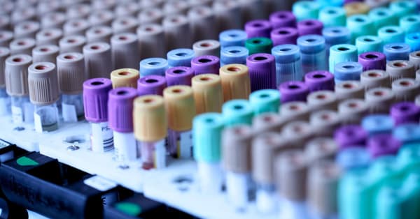 Supporting Genetic Research through Donations: Why It Matters