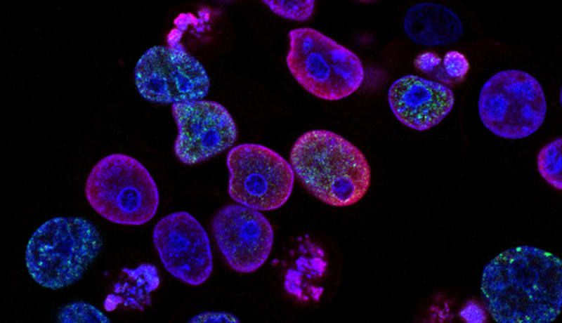 Photo of purple cells by National Cancer Institute on Unsplash
