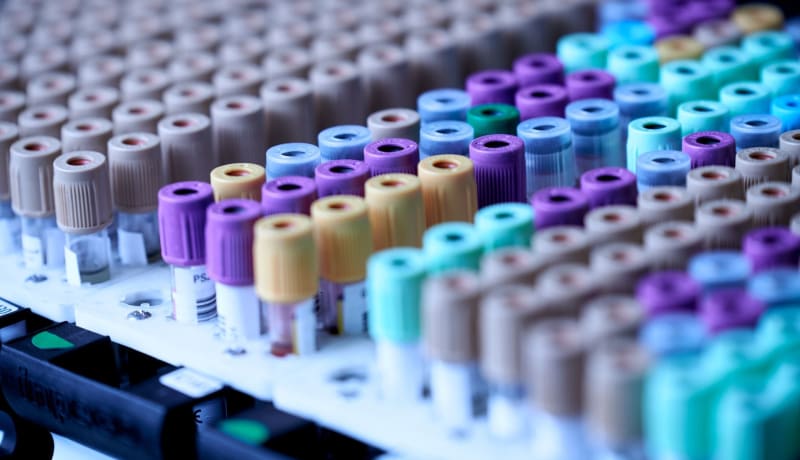Photo of medical equipment by Testalize.me on Unsplash