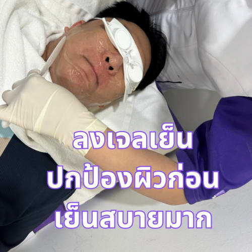 3-Energy Laser Hair Removal at Apex Profound Beauty รูปที่ 1