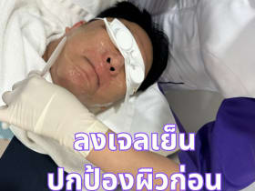 เลเซอร์ขน 3 พลังงาน Apex Profound Beauty