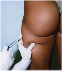 Mesotherapy against water retention