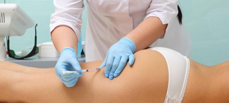 Mesotherapy injections vs cellulite