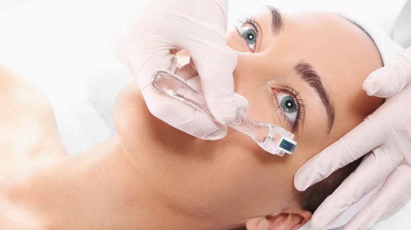The facial microneedling vs wrinkles