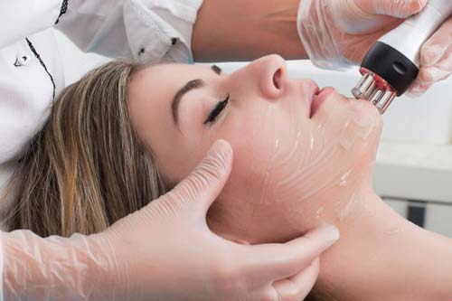 ACNE AND ACNE SCAR REMOVAL