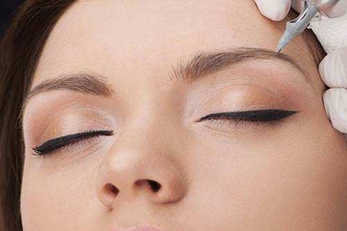 microblanding procedure