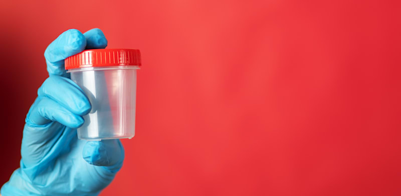 תרומת זרע / צילום: Shutterstock, Tikhonova Yana