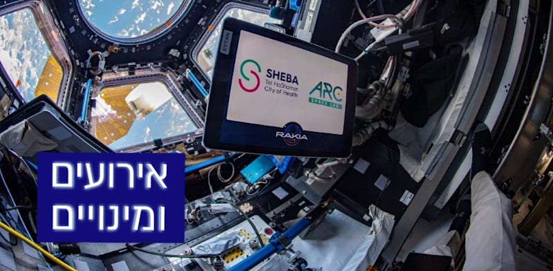 "ניסוי החלל הראשון של שיבא / צילום: Eytan Stibbe the Rakia Mission"