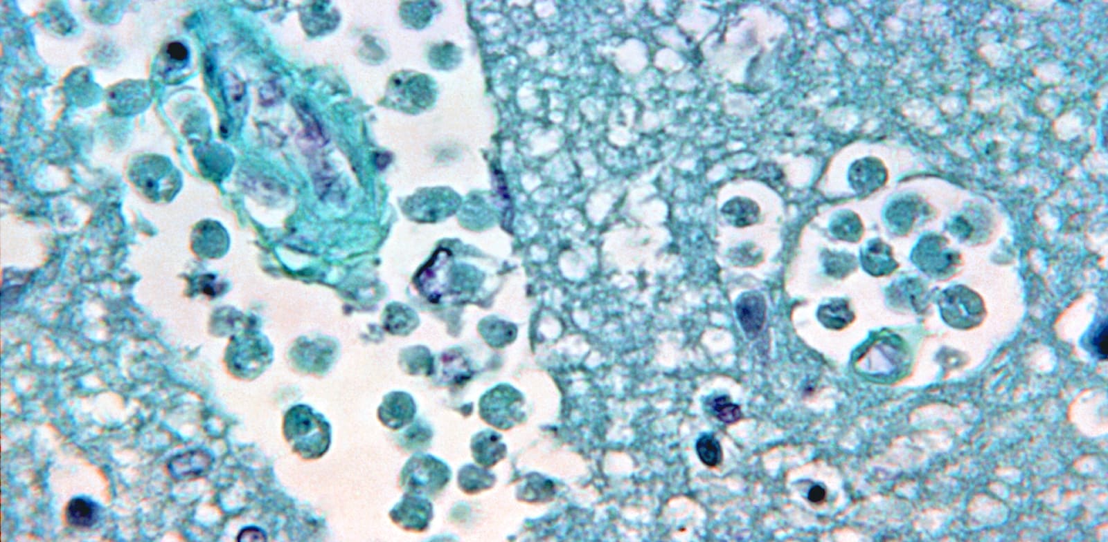 "צילום מיקרוסקופי של ''אמבה אוכלת מוח'' / צילום: Reuters, CDC"