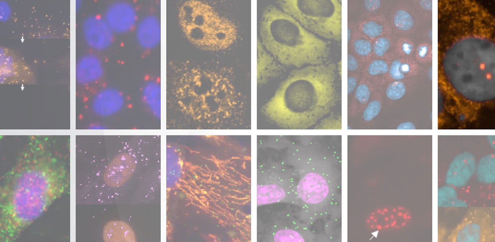 "מתוך המערכת שצובעת תאים ומגלה אם הם בריאים / צילום: באדיבות אנימה"