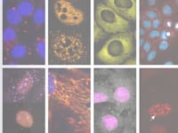 מתוך המערכת שצובעת תאים ומגלה אם הם בריאים / צילום: באדיבות אנימה