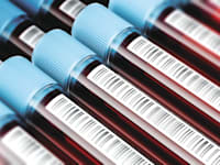 אילוסטרציה של דגימות דם / צילום: Shutterstock