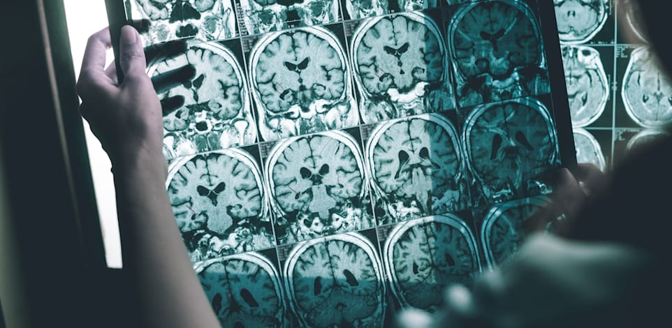 הדמיית MRI. האלמנטים הנדירים חיוניים / צילום: Shutterstock, Atthapon Raksthaput