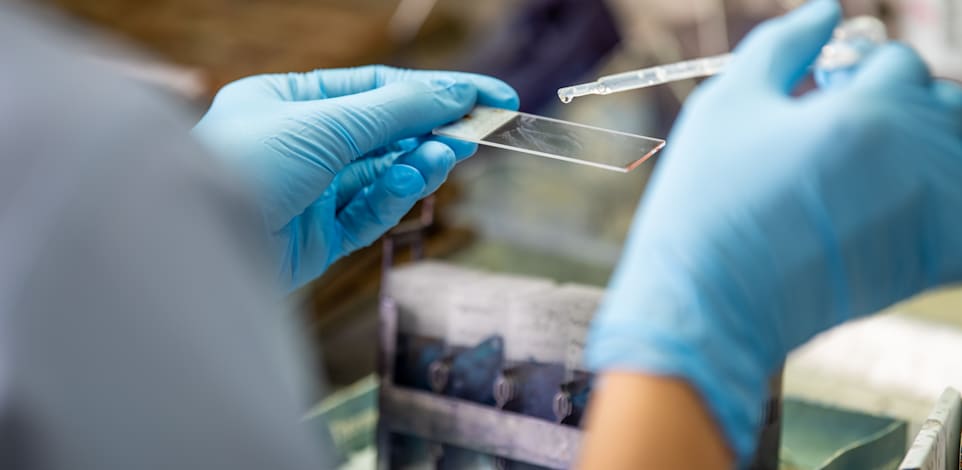 האם טיפול שפותח לסרטן יוביל למהפכה במחלות נוספות? / אילוסטרציה: Shutterstock