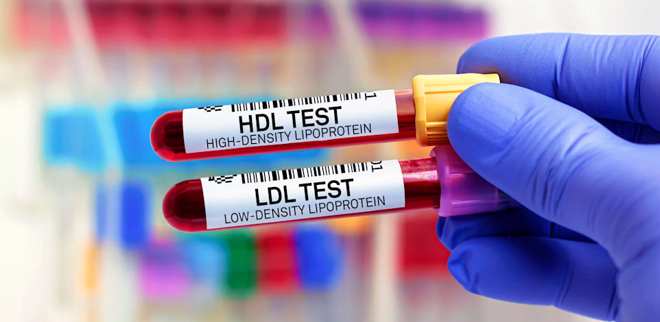 בדיקות כולסטרול / צילום: Shutterstock