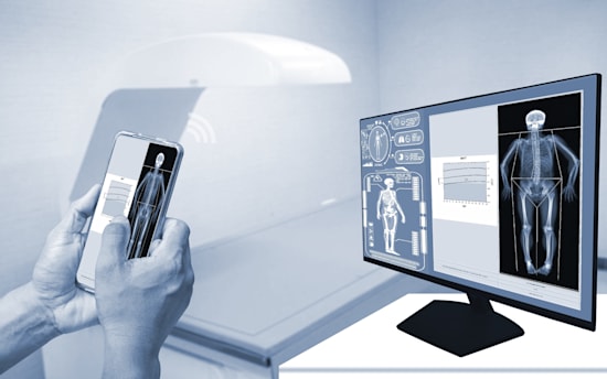 מכשיר DXA לבדיקת הרכב הגוף, שישתמשו בו בקליניקה / צילום: Shutterstock