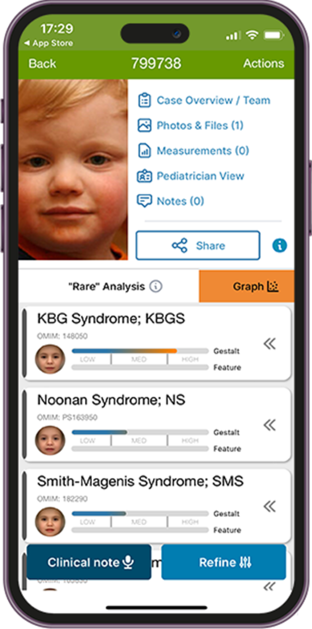 Face2Gene. אפליקציית AI שמזהה הפרעות גנטיות נדירות באמצעות ניתוח תווי פנים / צילום: צילום מסך