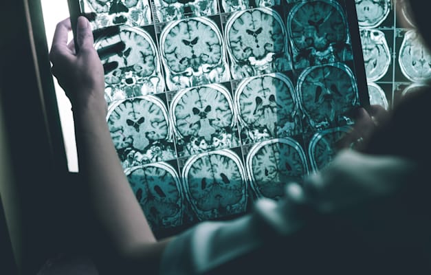 הדמיית MRI. האלמנטים הנדירים חיוניים / צילום: Shutterstock, Atthapon Raksthaput הדמיית MRI. האלמנטים הנדירים חיוניים / צילום: Shutterstock, Atthapon Raksthaput